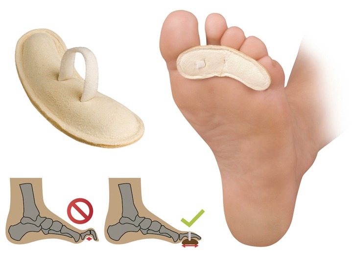 Gesunder Fuß - Zehen-Korrektor von Fußgut, in Größe 001 bis 003, in Farbe HAUT Ansicht 1
