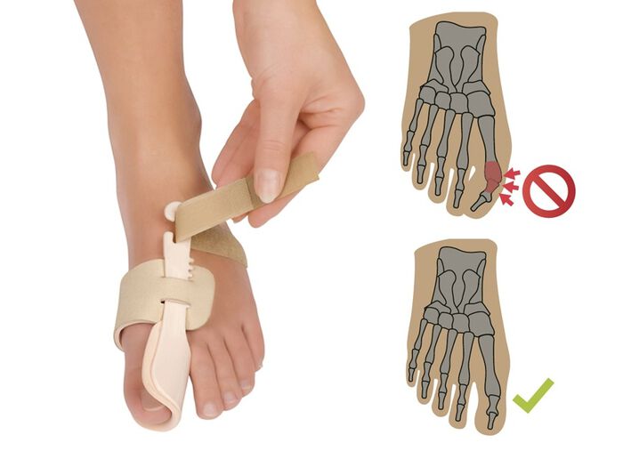 FußGut Nachtbandage 