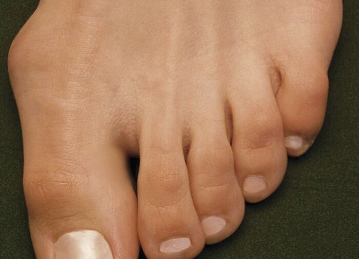Sandalette von Aerosoft in Weite G–H WEISS